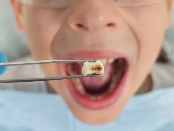 Best Emergency Pediatric Dentist  in Northlakes, NC